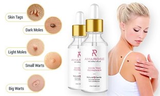 Amarose Skin Tag Remover Reviews in Cambridge